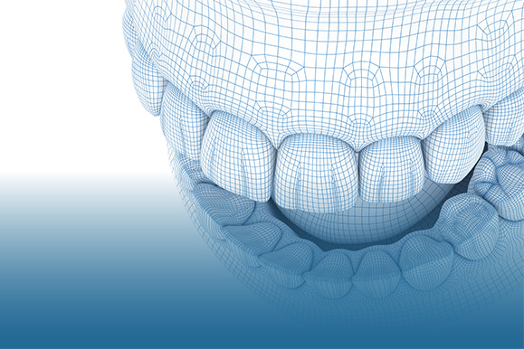 Focus Dental Turkey CAD / CAM Technology