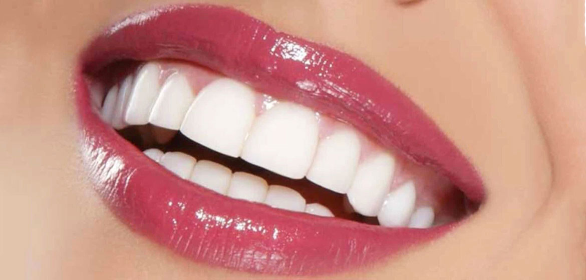 What Is The Cost of Hollywood Smile in Turkey?