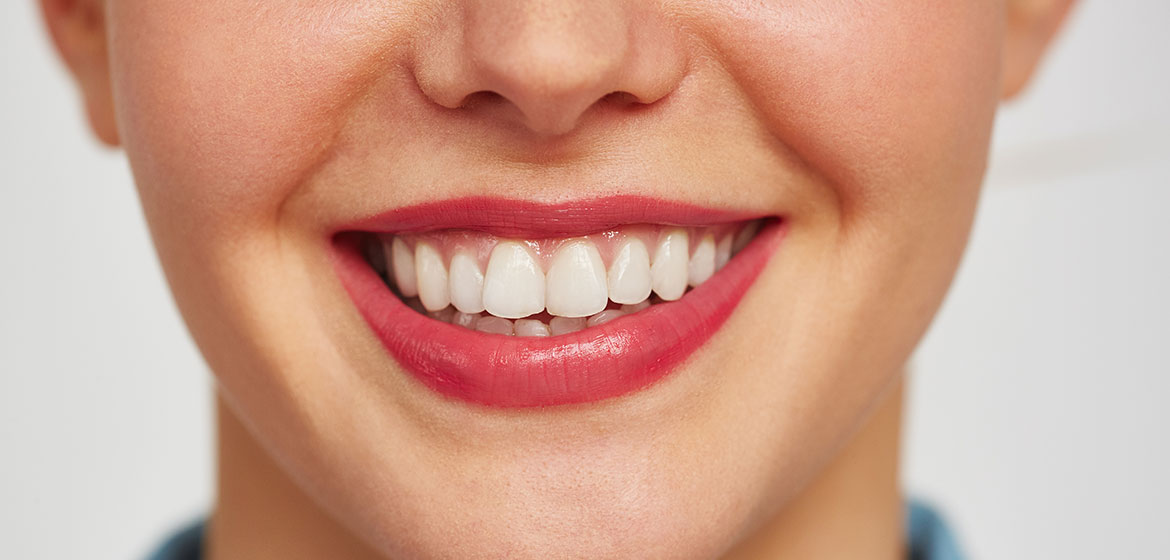 How Long Do Zirconia Veneers Last?