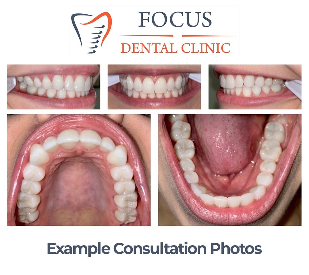 Example Consultation Photos